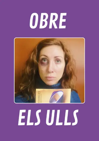 Obre els Ulls